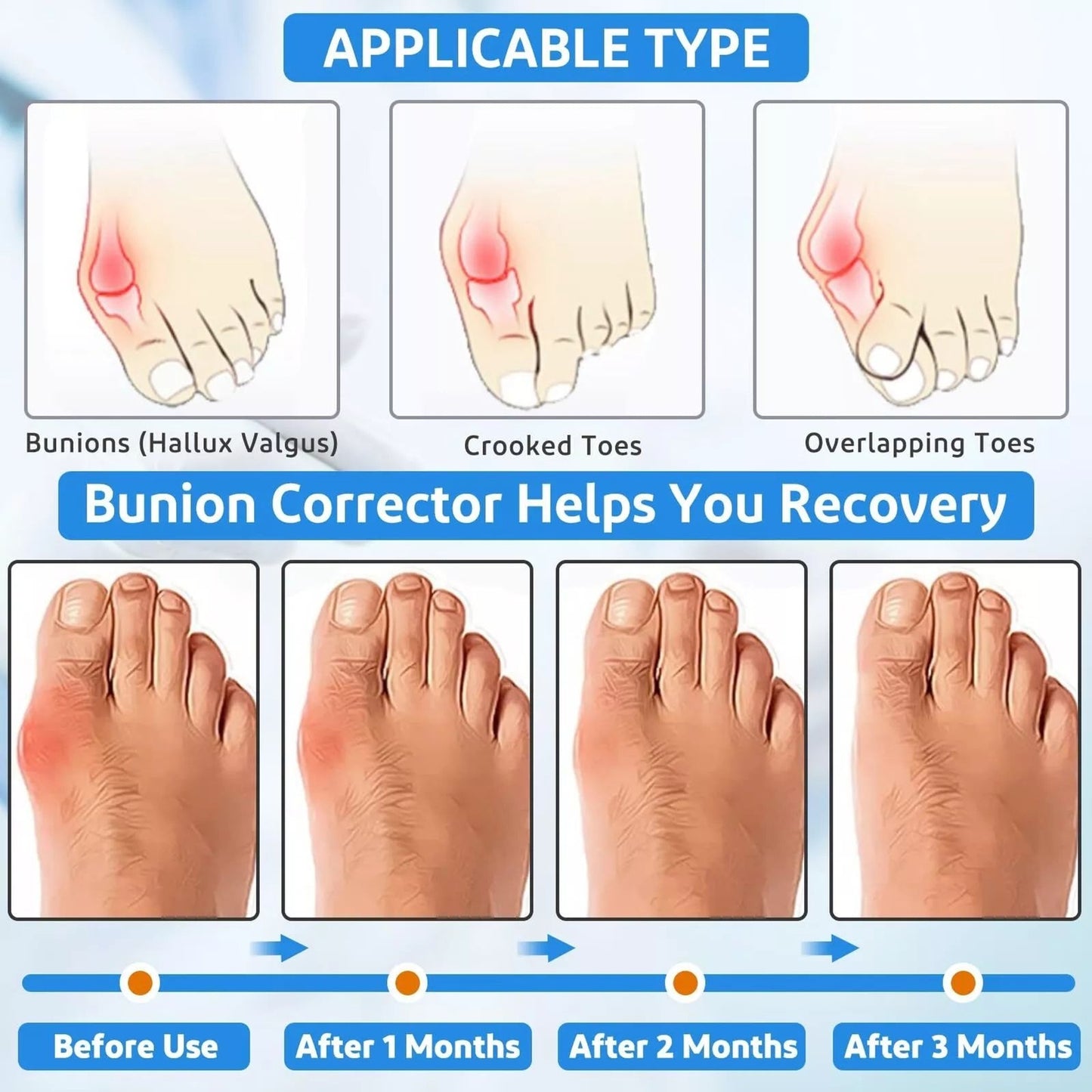 Healrecux Bunion Corrector for Men/Women - In Shoe - Factory Sealed